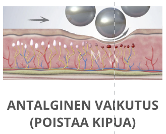 Endosphères-hoidon hyöty 1